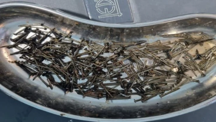 В Самарканде мужчина проглотил 200 граммов гвоздей и шурупов В Самарканде мужчина проглотил 200 граммов гвоздей и шурупов