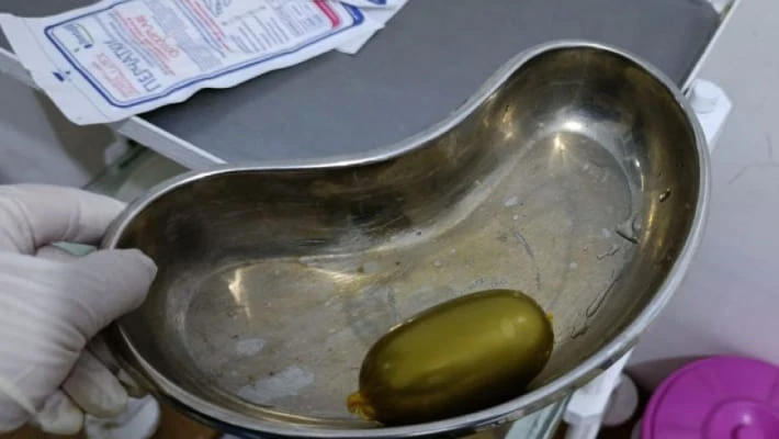 Супруги пытались ввезти 796 граммов опия, скрыв его внутри тела Супруги пытались ввезти 796 граммов опия, скрыв его внутри тела